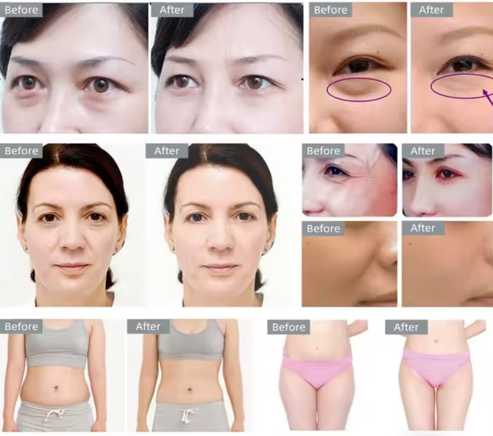 40K Ultrasonic Cavitation Machine, 3-in-1 Beauty Device, Skin Tightening & Face Lifting, Home Use Beauty Instrument